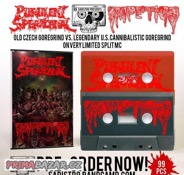 MC Kazeta IMPETIGO / PURULENT SPERMCANAL